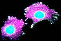 cellule tumorali 