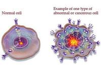 Cellula tumorale