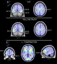 Menzogna - imaging neurale